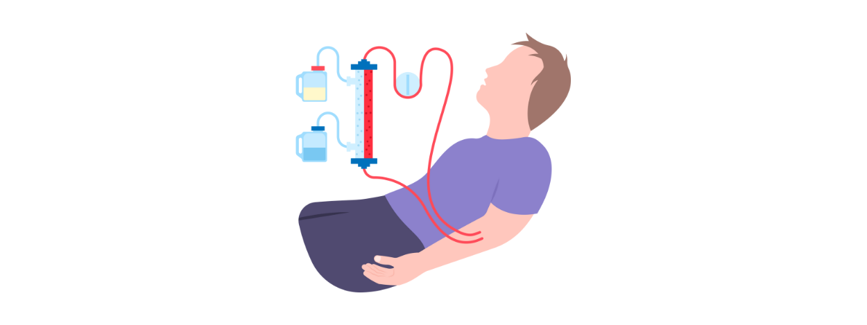Renal Transplant